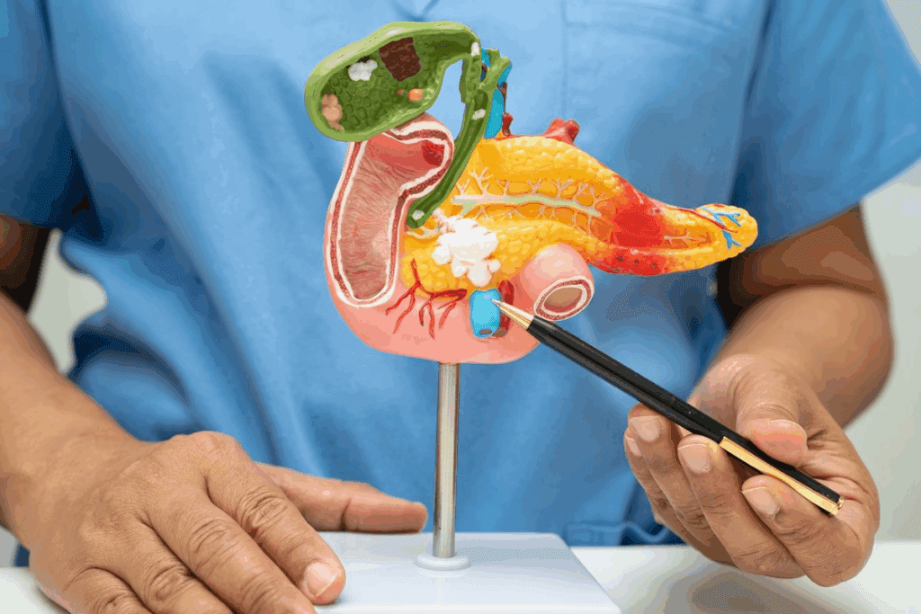 can you still get stones after gallbladder removal? Shocking Truth 2 can you still get stones after gallbladder removal? Truth