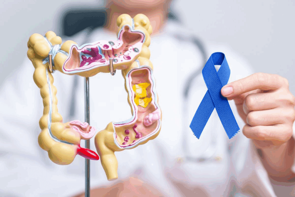 Risk of Colon Cancer by Age: The Shocking, Bad Trends