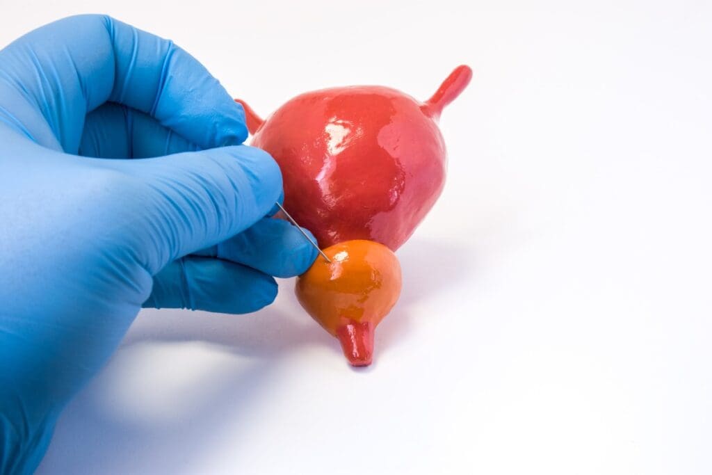 Can Stress Affect Prostate Size? | Hyperplasia Prostate Symptoms 3 Can Stress Affect Prostate Size? | Hyperplasia Prostate Symptoms