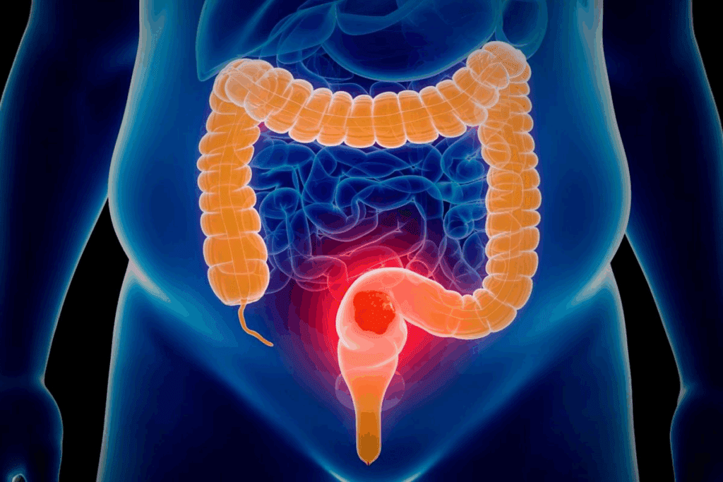 Where Is Your Colon and What Does It Do?