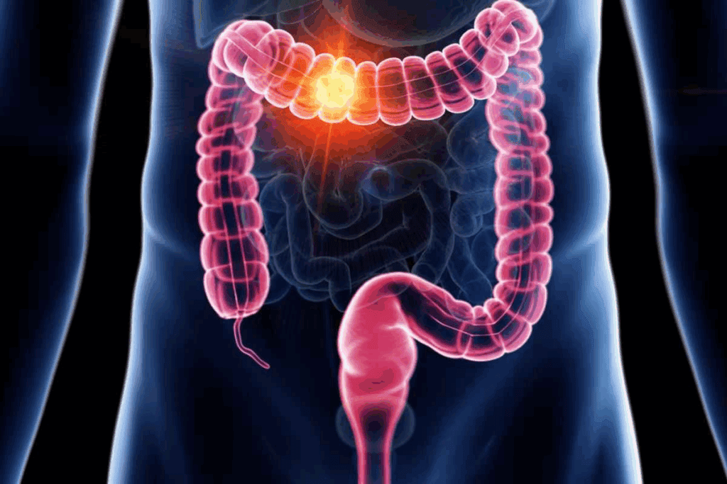 How Long Is the Colon? Real Length Explained