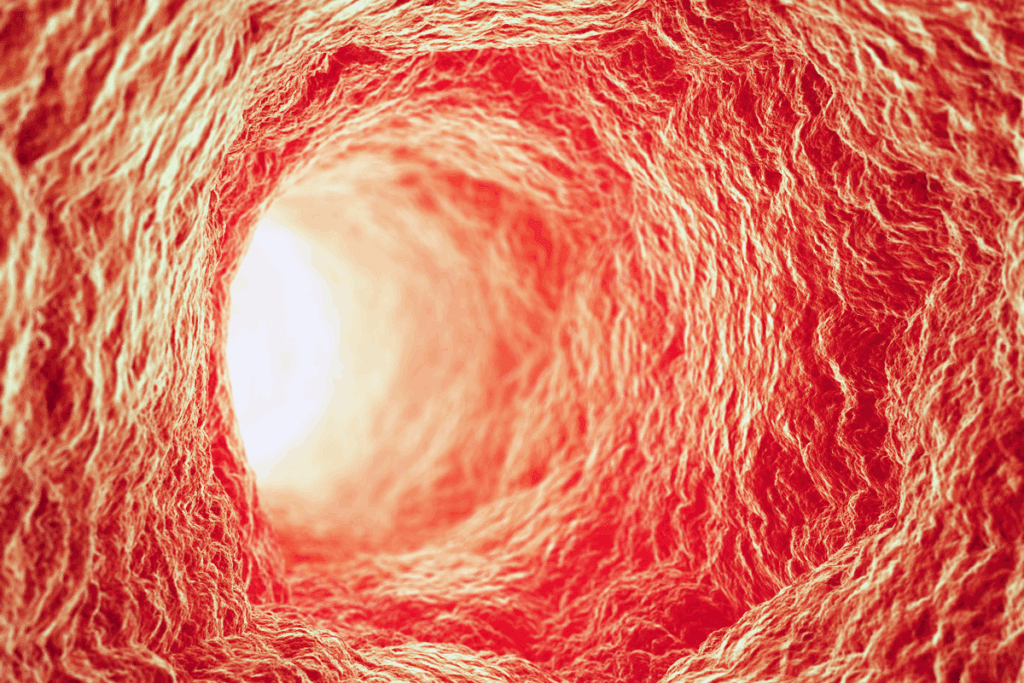 How Many Stents Can Be Placed in One Artery?
