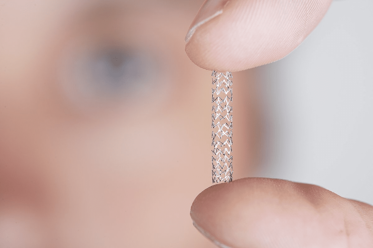 How Many Stents Can You Get? Surprising Facts