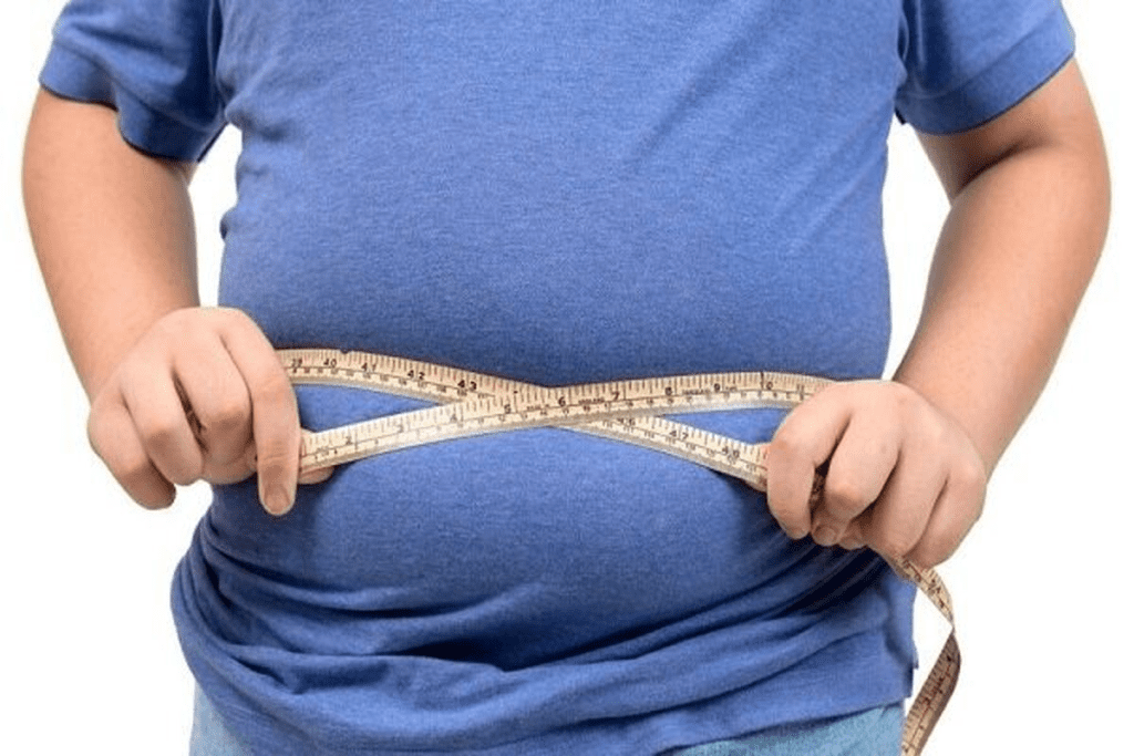 Does Weight Loss Truly Improve Peyronie's Disease Treatments? 1 Does Weight Loss Truly Improve Peyronie's Disease Treatments?