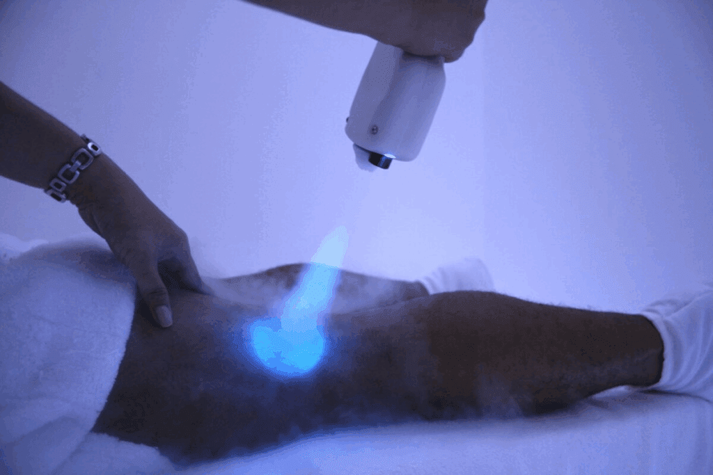 5 Best Ways Cryo Cancer Using Extreme Cold 2 5 Best Ways Cryo Cancer Using Extreme Cold