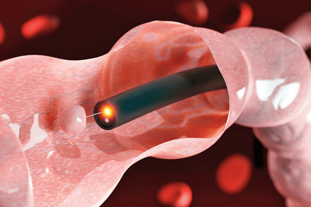 Recognizing the Key Symptoms of Bladder Polyps
