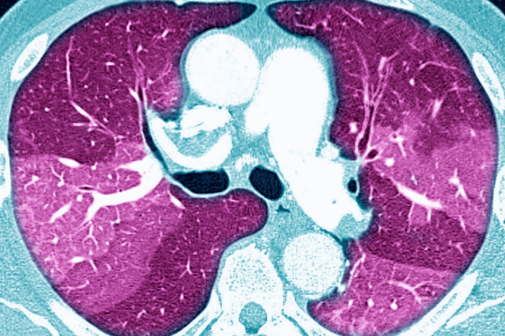 How to Prepare for and Understand a Guided CT Scan Lung Biopsy Step by Step