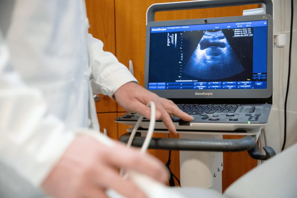 Reasons Why a Urologist Orders an Ultrasound Scan
