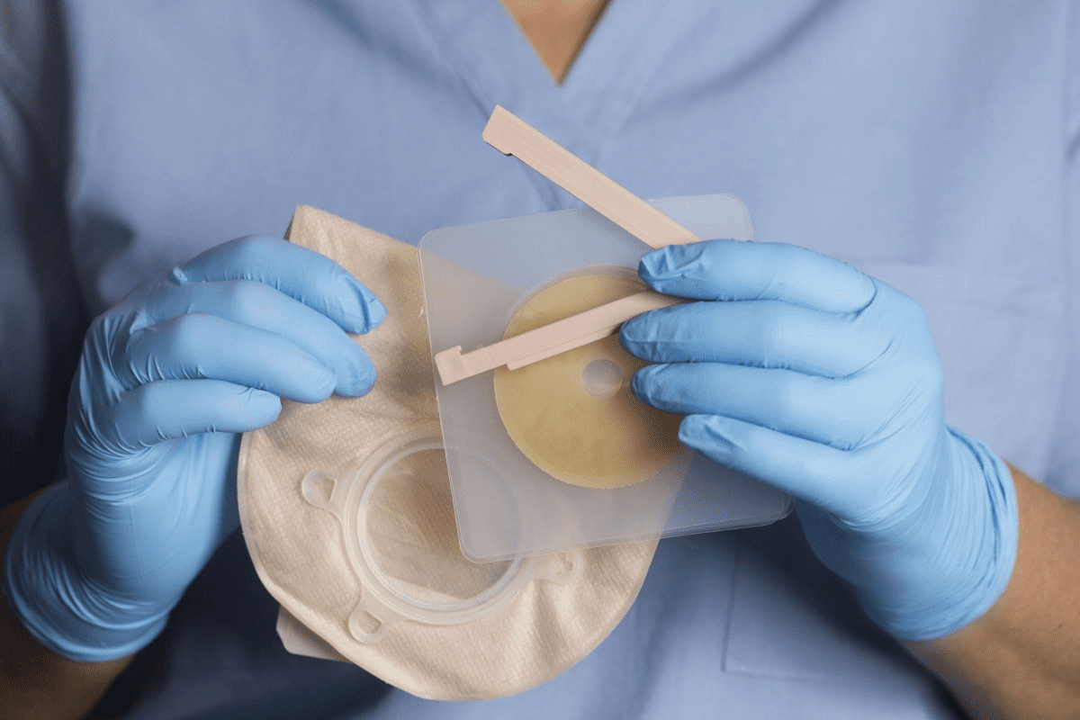 How Does a Stoma Bag Work? Step-by-Step