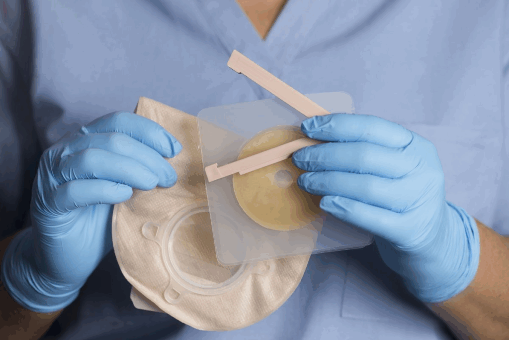 Colostomy Bag Hole: How to Cut Perfectly