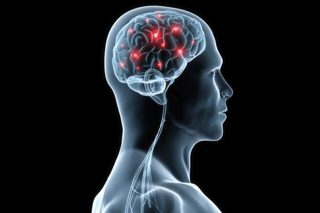 Does Hypothyroidism Cause Depression?