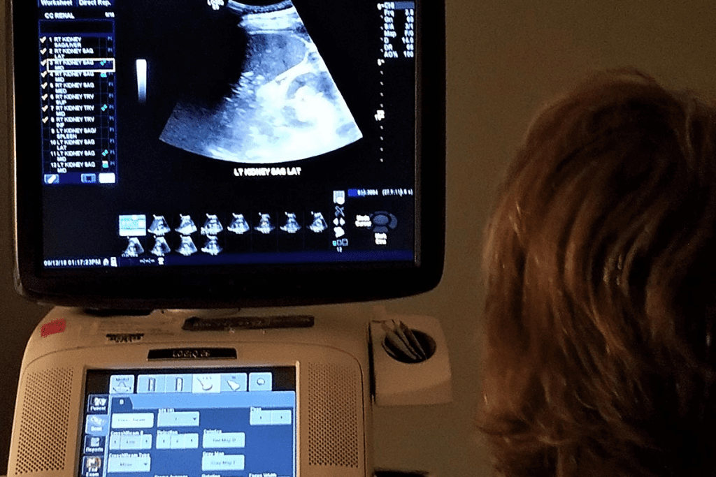 Urological Ultrasound Explained: Powerful Insights on What Does it Show? 1 Urological Ultrasound Explained: What Does it Show?