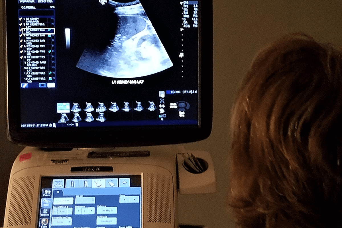 Urological Ultrasound Explained: What Does it Show?