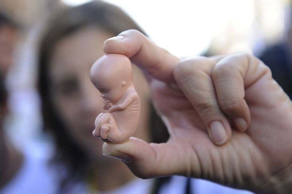 Fetal Genetic Abnormalities: Causes of Genetic Disorders