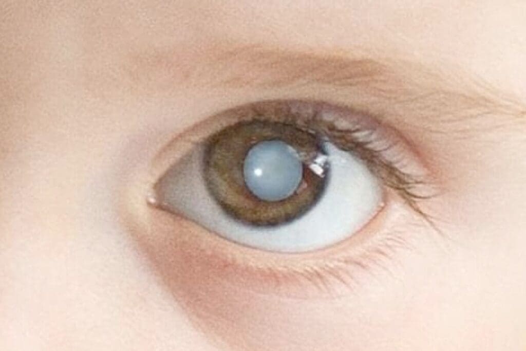 What Is a Congenital Anomaly Called? 7 Powerful Facts About Anomalies 1 What is a Congenital Anomaly Called? Exploring anomalies