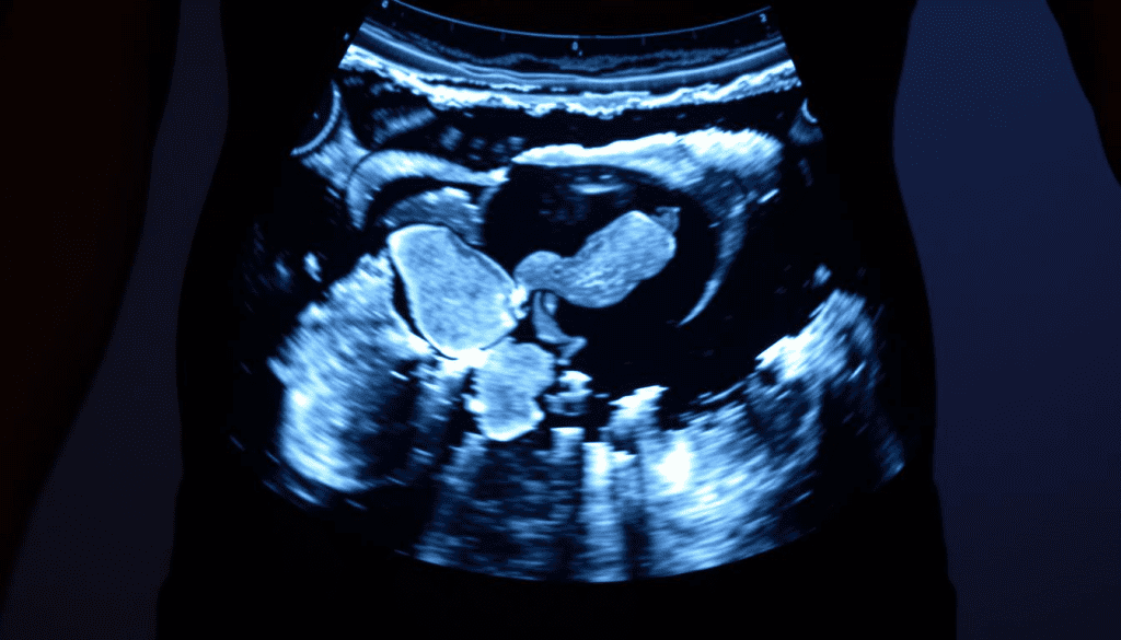 Pelvic Ultrasound: Eating Before Exam 3 Pelvic Ultrasound: Eating Before Exam