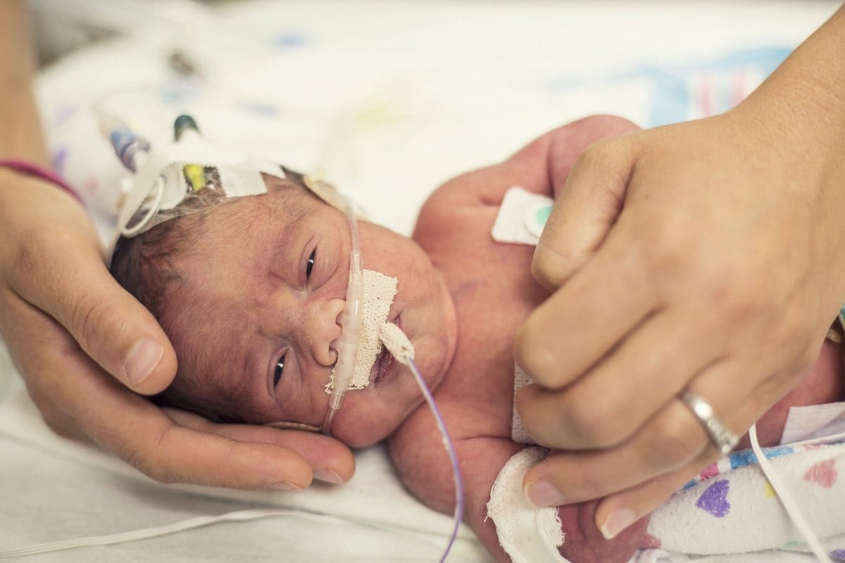 Understanding Multiple Congenital Anomalies in Children
