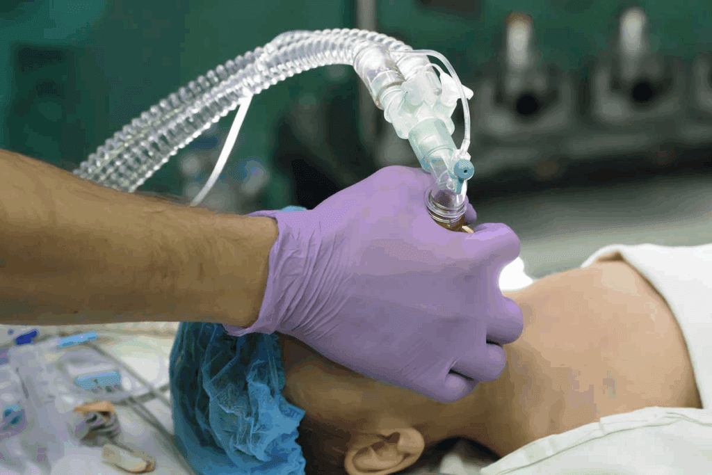 Do You Have to Be Intubated for General Anesthesia?