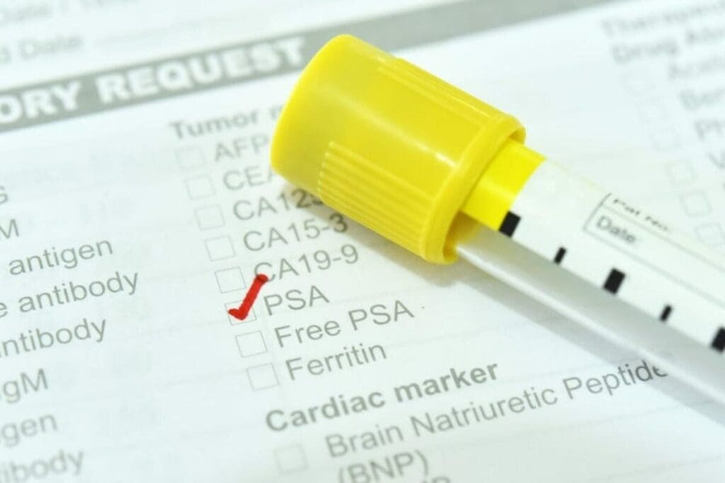 Why PSA Test Not Recommended After 70 | My PSA Is 56 2 Why PSA Test Not Recommended After 70 | My PSA Is 56