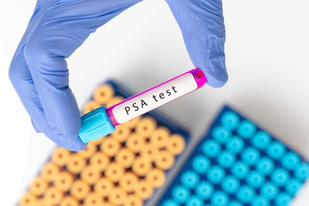 Why PSA Test Not Recommended After 70 | My PSA Is 56 3 Why PSA Test Not Recommended After 70 | My PSA Is 56