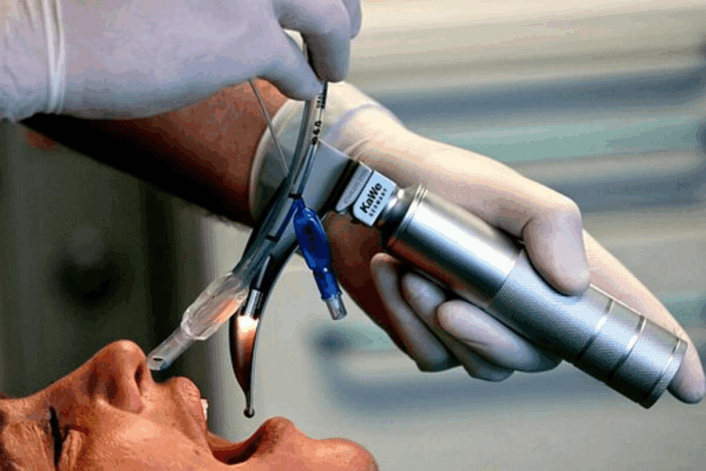 General Anaesthetic Intubation: Safe Steps 1 General Anaesthetic Intubation: Safe Steps