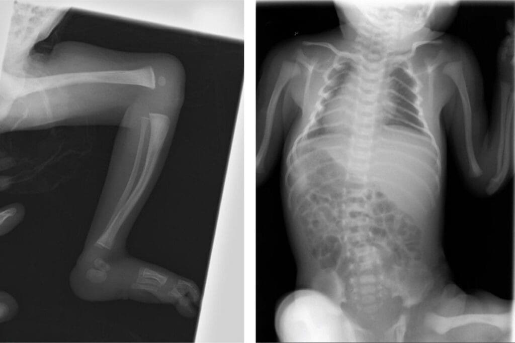 Major vs. Minor Congenital Anomalies: What's the Difference?