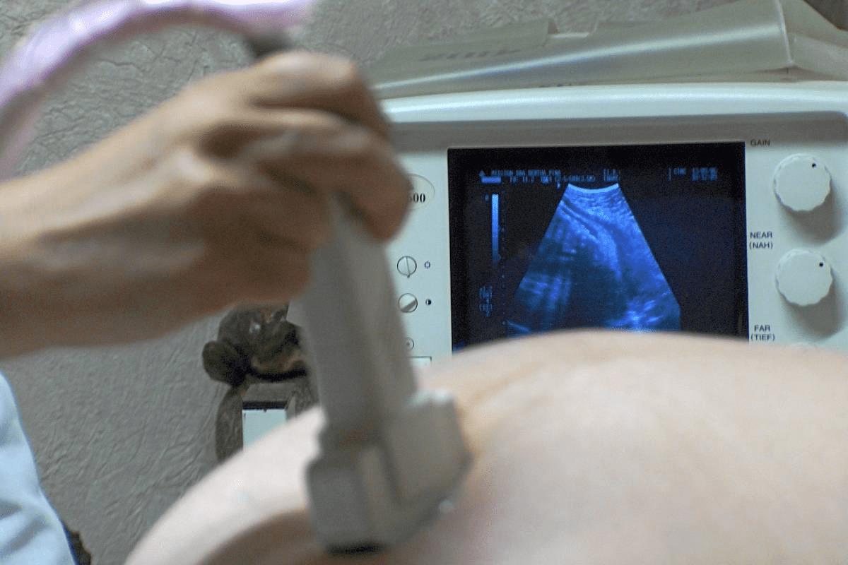 Bladder Ultrasound: Timeframe for Procedure