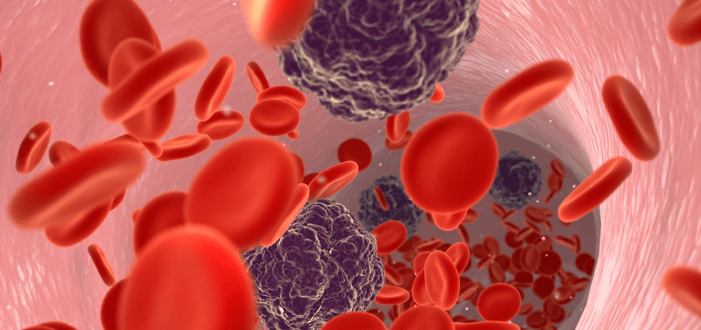 Childhood Cancers: List of Most Common Types