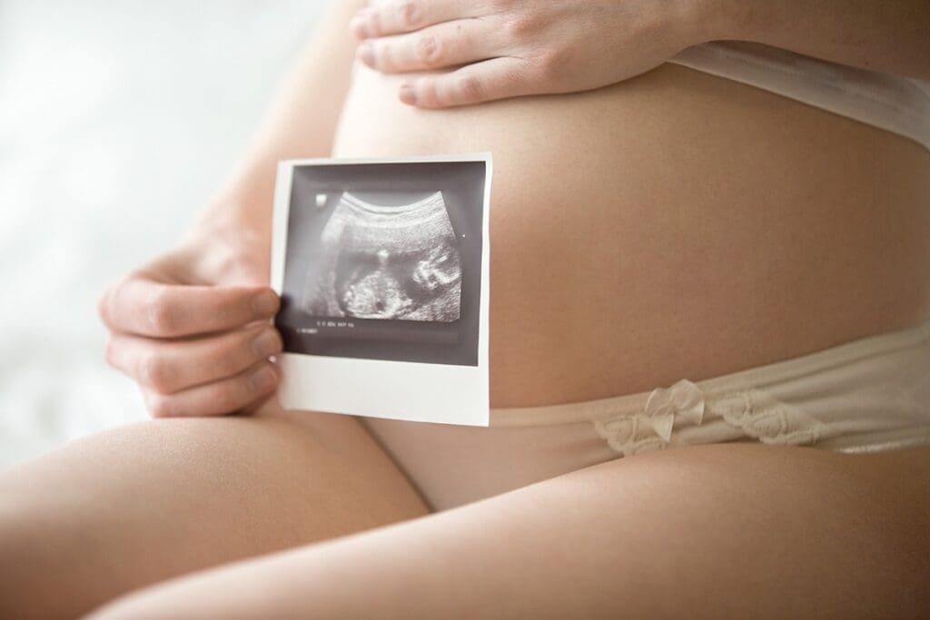 Avoiding Chromosomal Abnormalities: Preventing Birth Defects