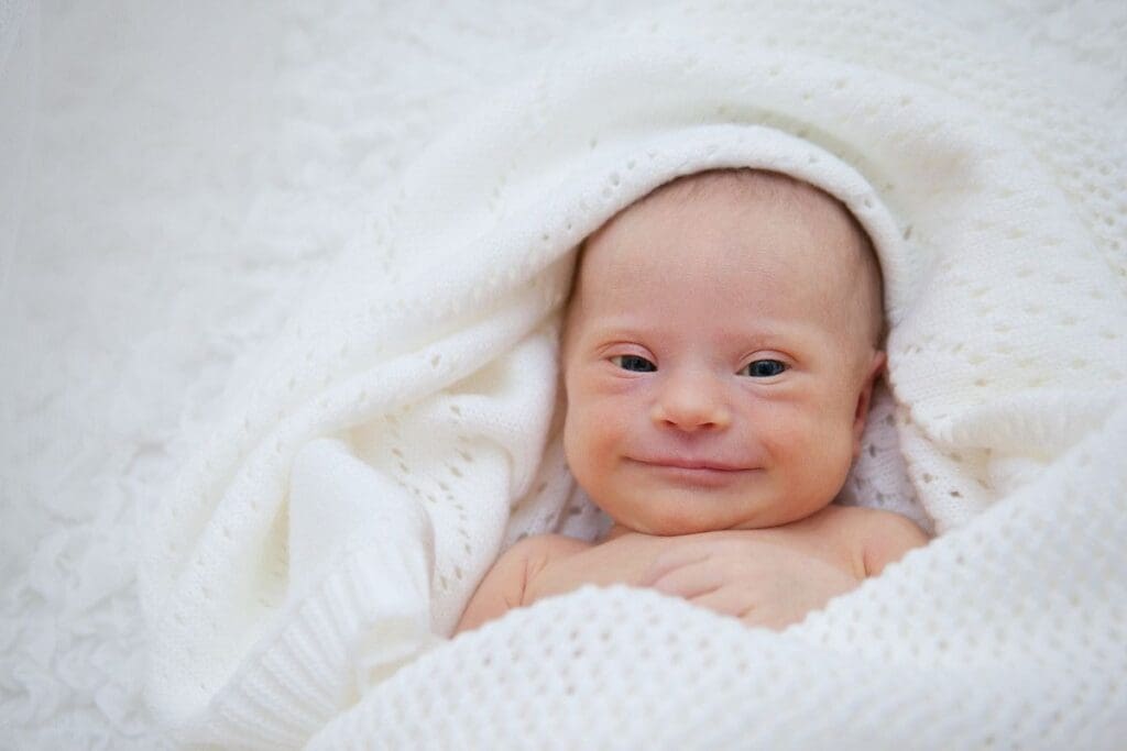 Down Syndrome: A Key Example of a Congenital Anomaly 3 Down Syndrome: A Key Example of a Congenital Anomaly