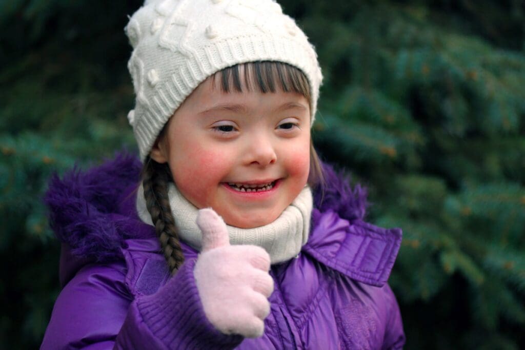 Down Syndrome: A Key Example of a Congenital Anomaly 2 Down Syndrome: A Key Example of a Congenital Anomaly