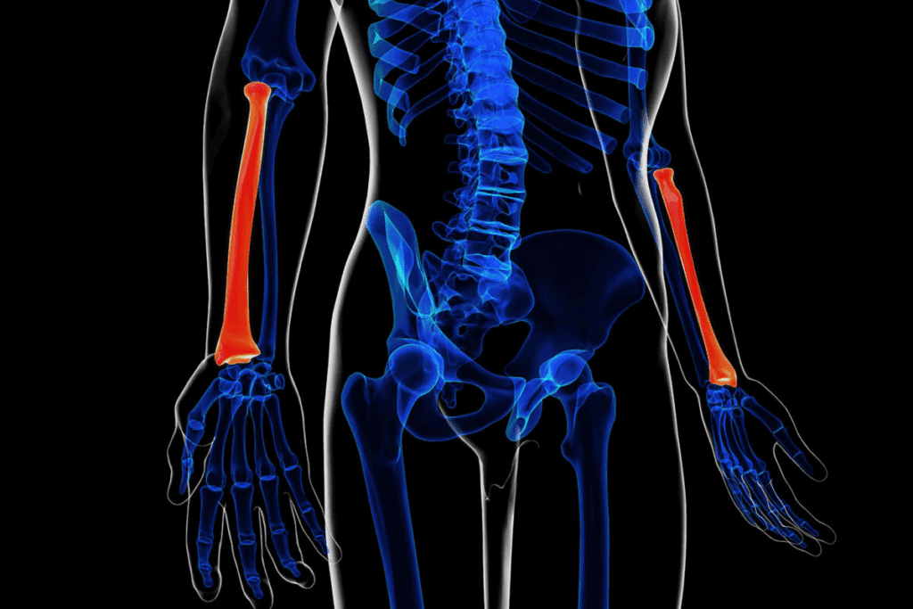 L1 Compression Fracture Treatment: Top Options