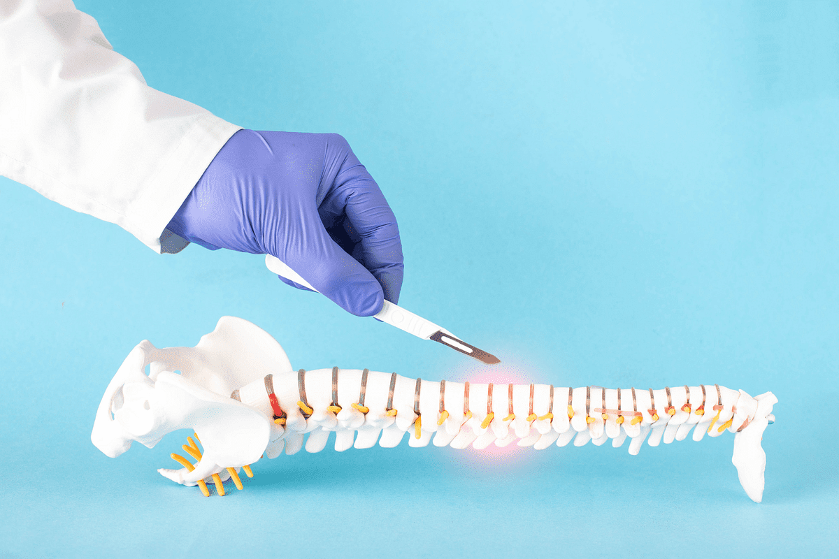 Cement in Vertebrae: The Ultimate Surgery Guide