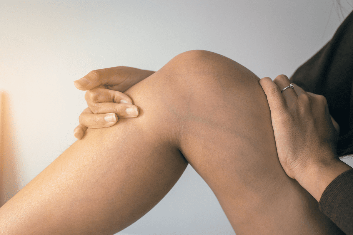 Can you get rid of blood clots? Surprising Truth