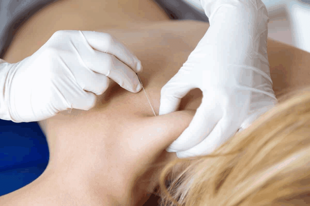 How Long Will an Epidural Last? Powerful Relief