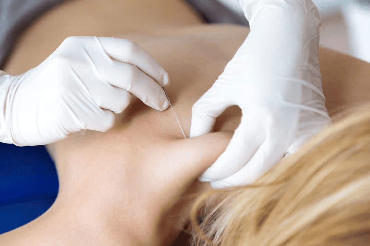 Wondering 'how long will an epidural last' for back pain? Our guide explains the duration of powerful relief and what you should expect.