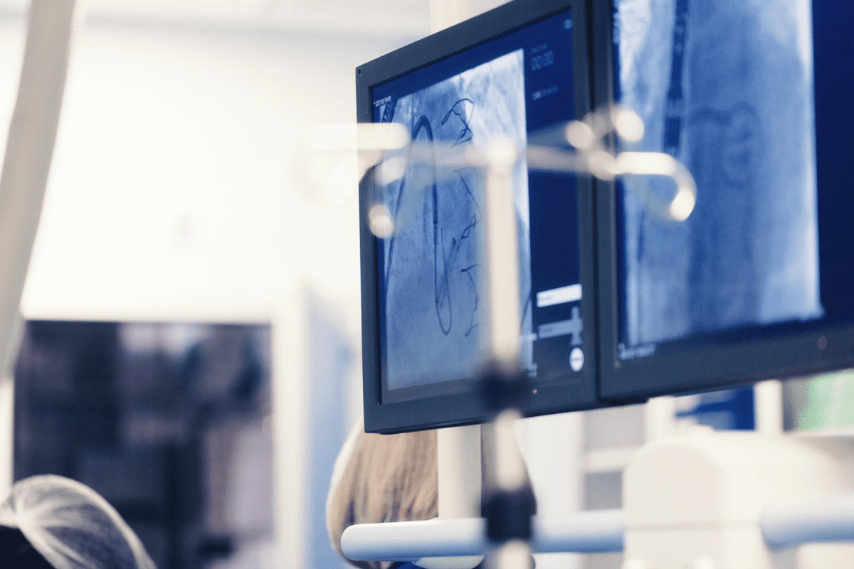 How Long After a Stent Can You Fly? Driving Rules