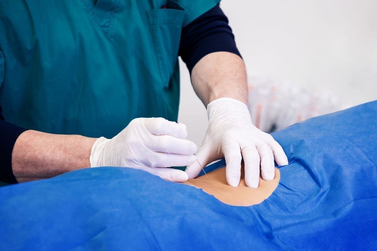 Complications of Kids' Inguinal Hernia Surgery