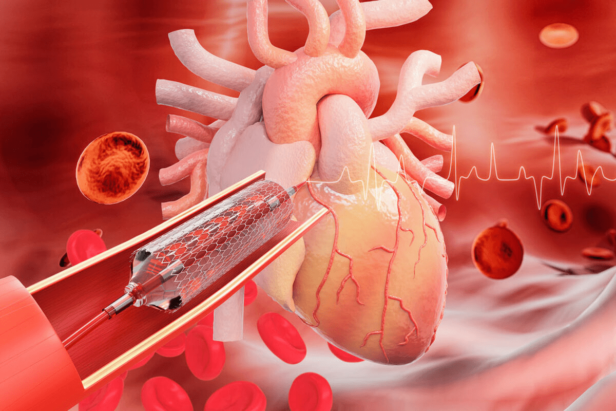 How Does a Beta Blocker Work? 7 Key Facts