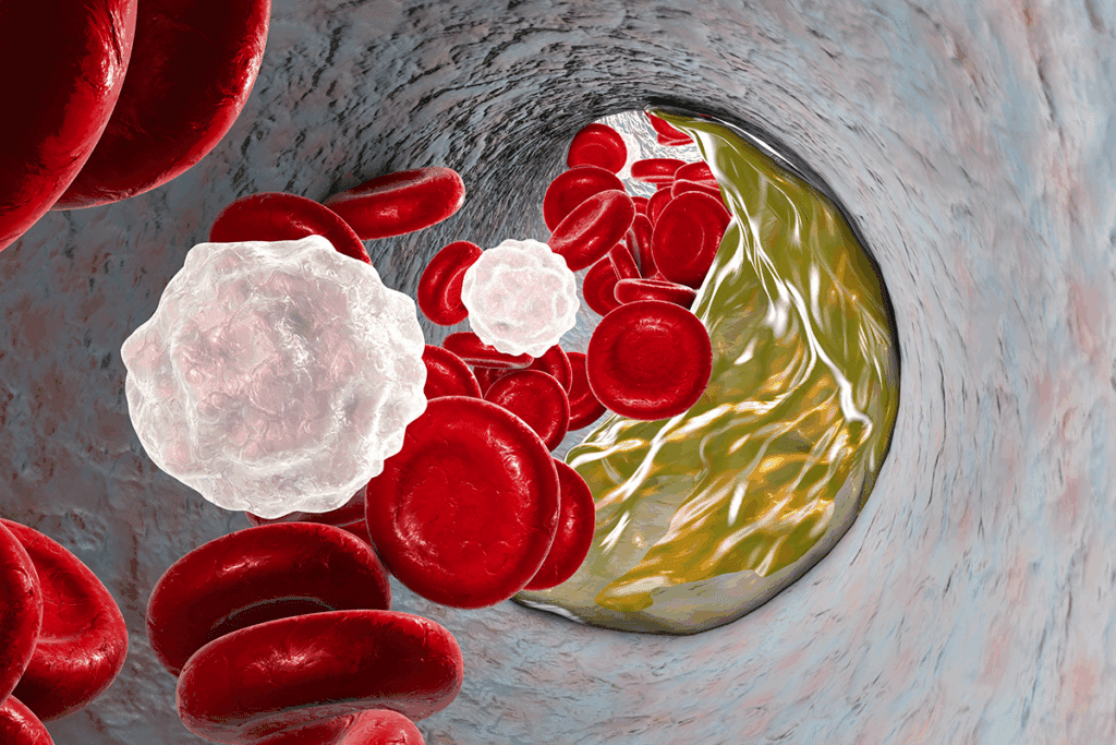 Average Age of Heart Attack in Females: Key Facts