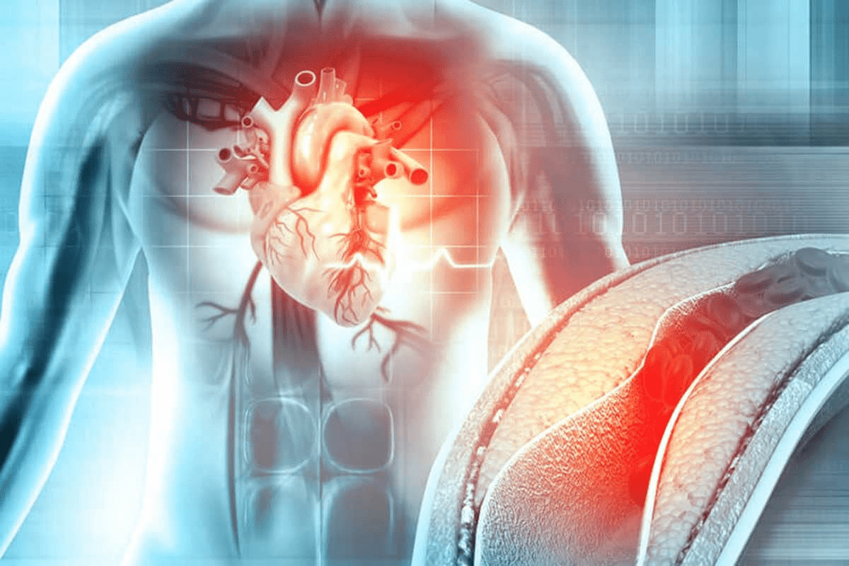 Discover 10 major ASCVD risk factors for accurate 2024 heart disease prediction and prevention insights.