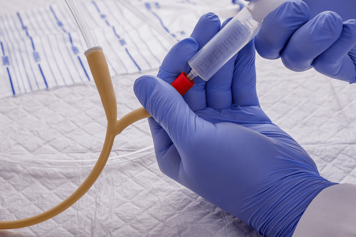 Factors That Can Affect Your Urinary Flow Test Results