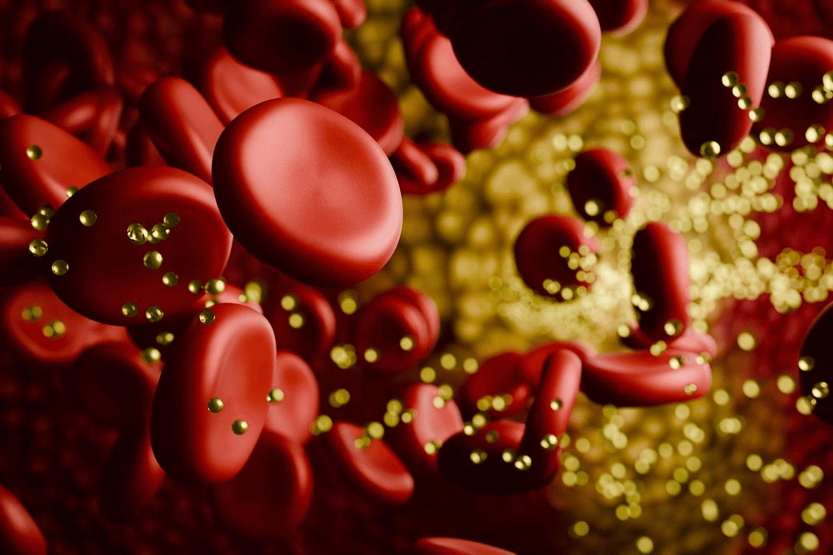 what are the 4 stages of coronary artery disease: Quick Facts