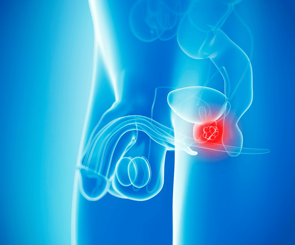 Essential Guide: How to Drain the Prostate Gland? prostate massage