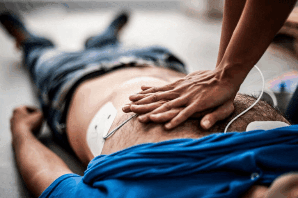 Cardiorespiratory Arrest Symptoms 3 Cardiorespiratory Arrest Symptoms