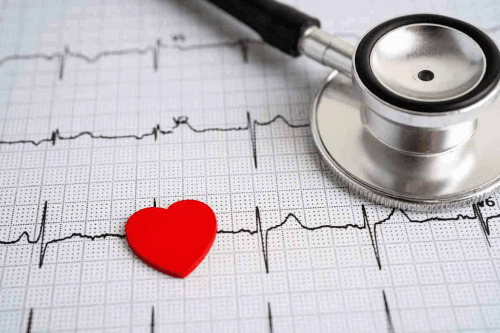 What Is a Dysrhythmia in the Heart? Full Explanation