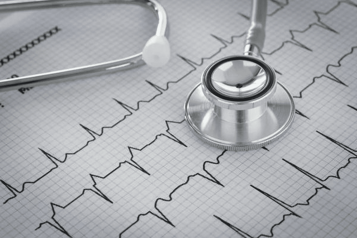 What Does a Treadmill Stress Test Show About Blocked Arteries and Heart Health?