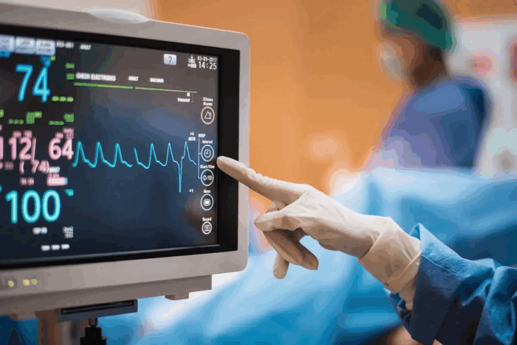 Complete Heart Block: ECG Findings