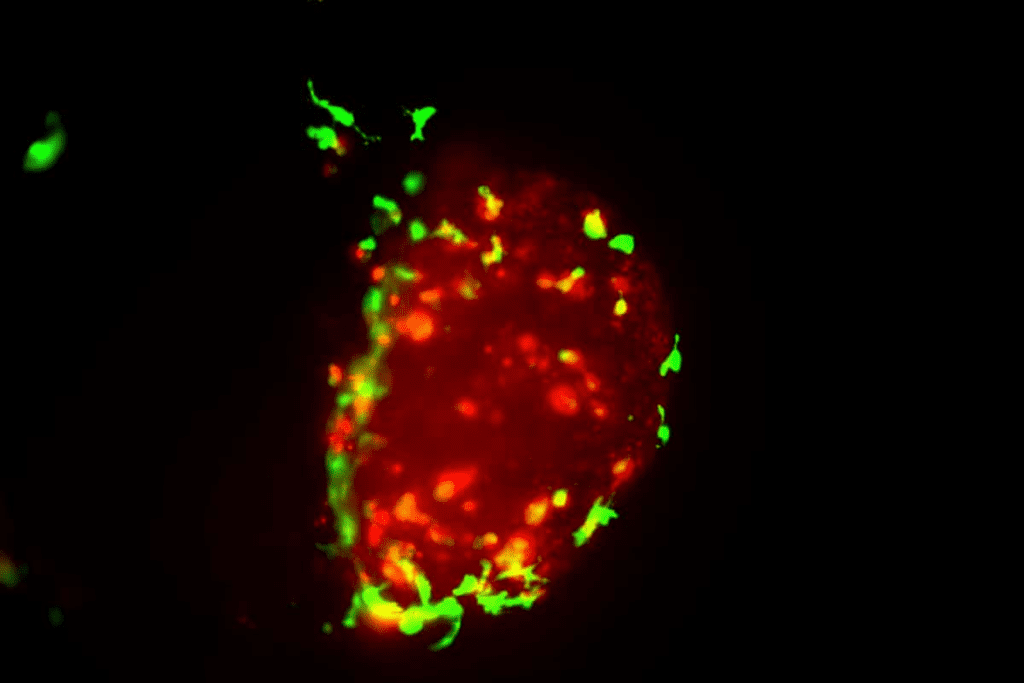 Critical Warning: Signs of a Tumor? bladder cancer symptoms