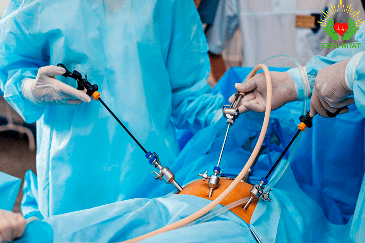 Prostatectomy: Removing It a Big Operation